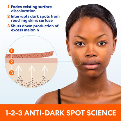 Palmer's Skin Success Anti-Dark Spot Fade Cream with Vitamin E and Niacinamide, for All Skin Types 2.7 Ounce - Maple Wellness Supplements
