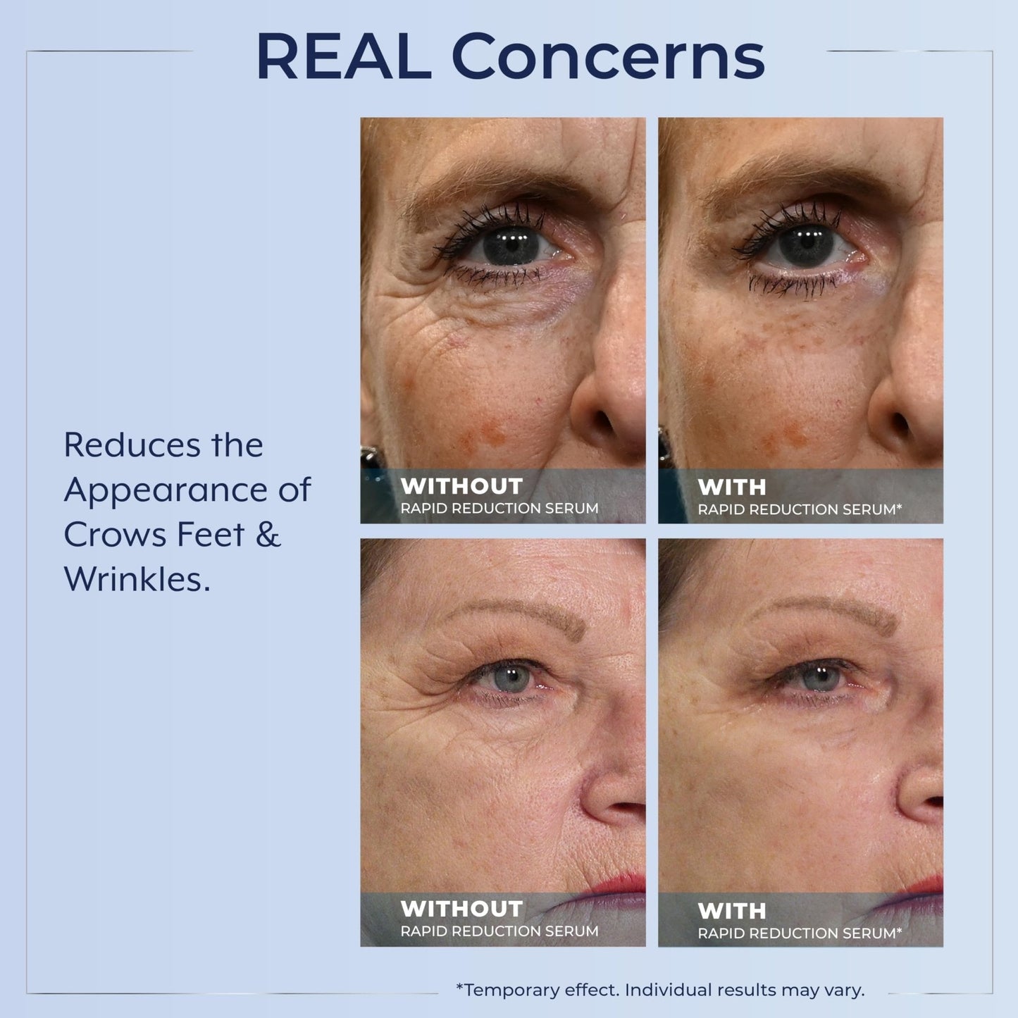 Plexaderm Rapid Reduction Eye Serum - Visibly Reduces Under-Eye Bags, Wrinkles, Dark Circles, Fine Lines & Crow's Feet Instantly - Maple Wellness Supplements