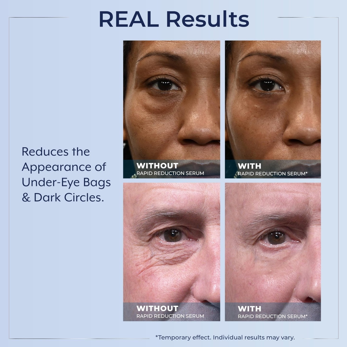 Plexaderm Rapid Reduction Eye Serum - Visibly Reduces Under-Eye Bags, Wrinkles, Dark Circles, Fine Lines & Crow's Feet Instantly - Maple Wellness Supplements