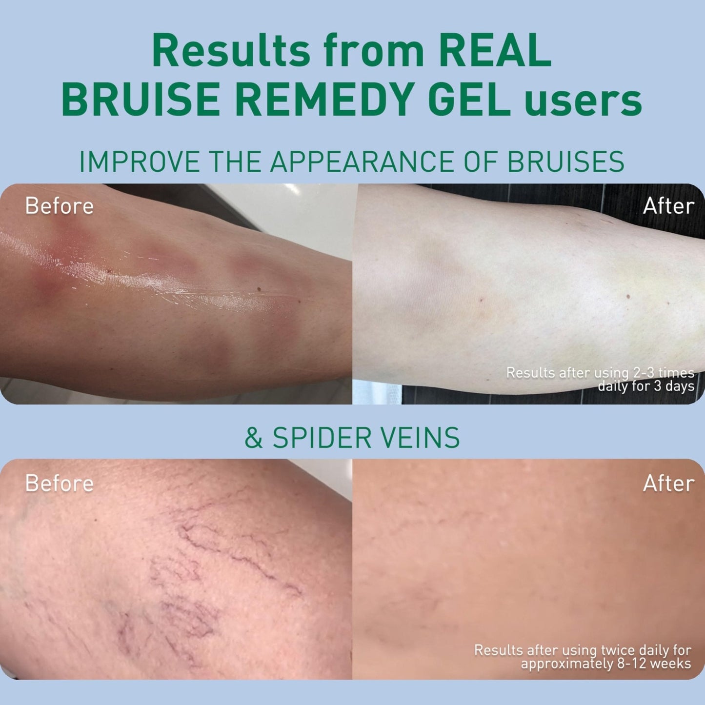 PROcure Arnica & MSM Bruise Remedy Gel – Paraben-Free, Unscented Arnica Montana Gel for Bruising, Spider Veins & Skin Discoloration – 2 Pack - Maple Wellness Supplements
