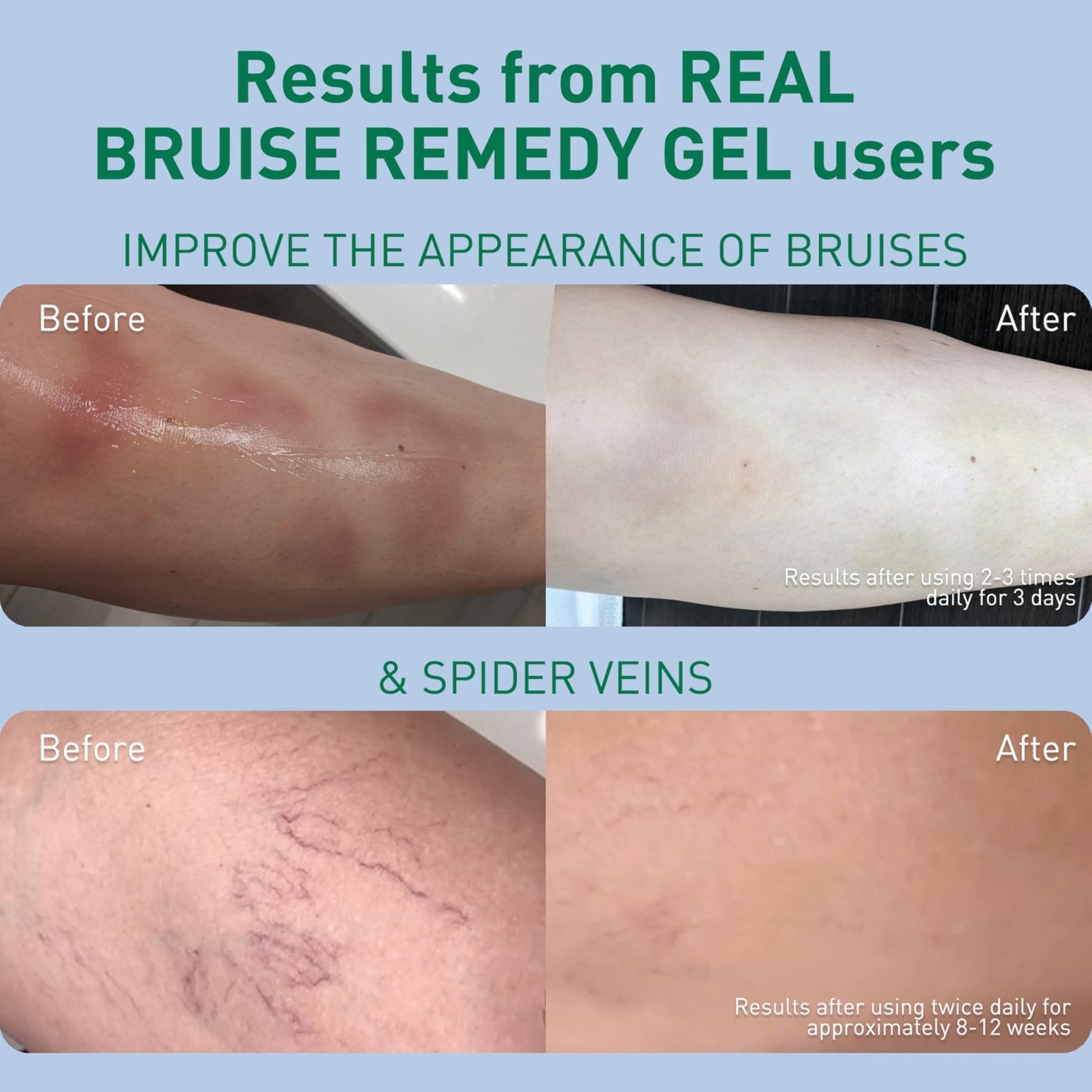 PROcure Arnica & MSM Bruise Remedy Gel – Paraben-Free, Unscented Arnica Montana Gel for Bruising, Spider Veins & Skin Discoloration – 2 Pack - Maple Wellness Supplements