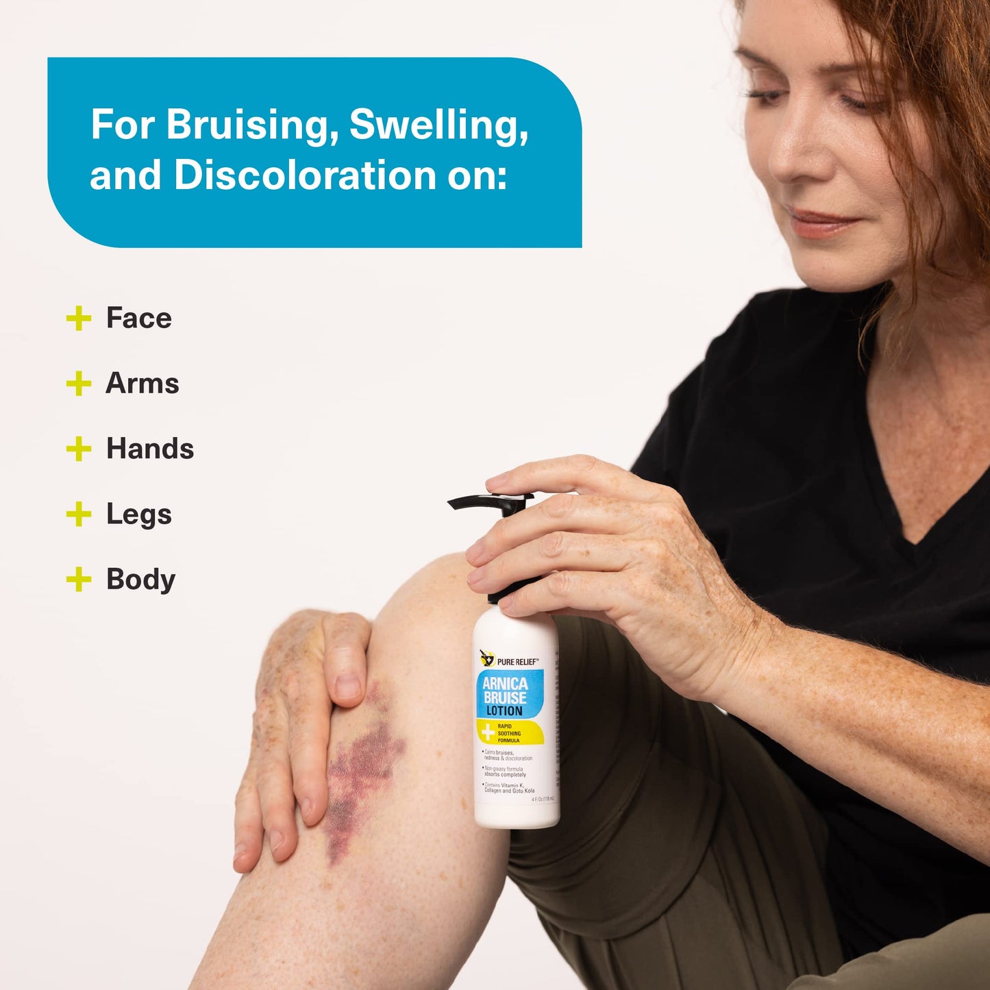 Pure Relief Arnica Bruise Relief Lotion for Bruising, Swelling, & Discoloration On Skin, Natural Skin Care Arnica Bruise Homeopathic Topical Bruise Cream W/Aloe Vera & Collagen, 4 Fl Oz (Pack of 3) - Maple Wellness Supplements