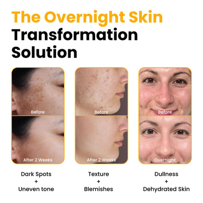 QUIA Turmeric + Kojic Acid Overnight Wrapping Mask – Hydration Mask for Glowing Skin - Maple Wellness Supplements