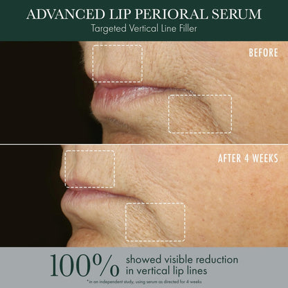 RéVive Advanced Perioral Lip Serum - Anti Aging Perioral Lip Treatment to Reduce Lip Area Lines & Wrinkles -Helps Restore Lip Contour & Visible Fullness(0.5 fl oz) - Maple Wellness Supplements