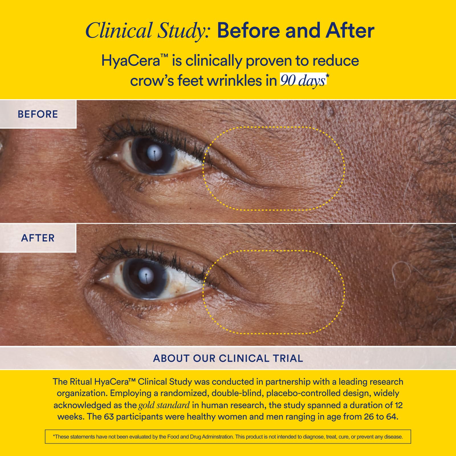 Ritual Hyaluronic Acid Skin Supplement - With Hyabest® and Ceratiq® - HyaCera Clinically Proven to Reduce Wrinkles, Fine Lines & Improve Skin Smoothness - Maple Wellness Supplements