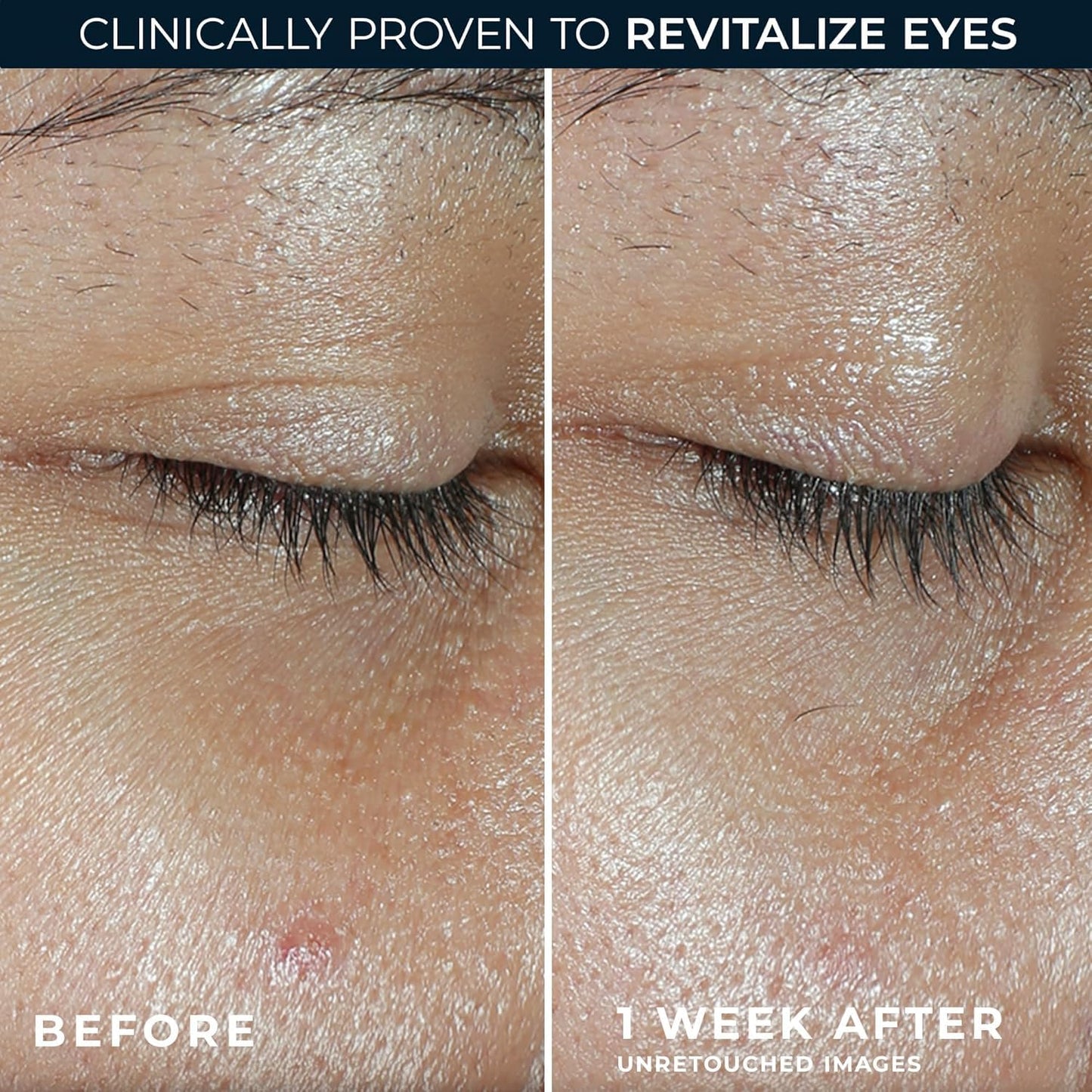 RoC Multi Correxion Revive + Glow Eye Balm with Vitamin C (0.14 oz) + Retinol Eye Cream Packette - Maple Wellness Supplements