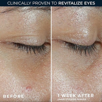 RoC Multi Correxion Revive + Glow Eye Balm with Vitamin C (0.14 oz) + Retinol Eye Cream Packette - Maple Wellness Supplements