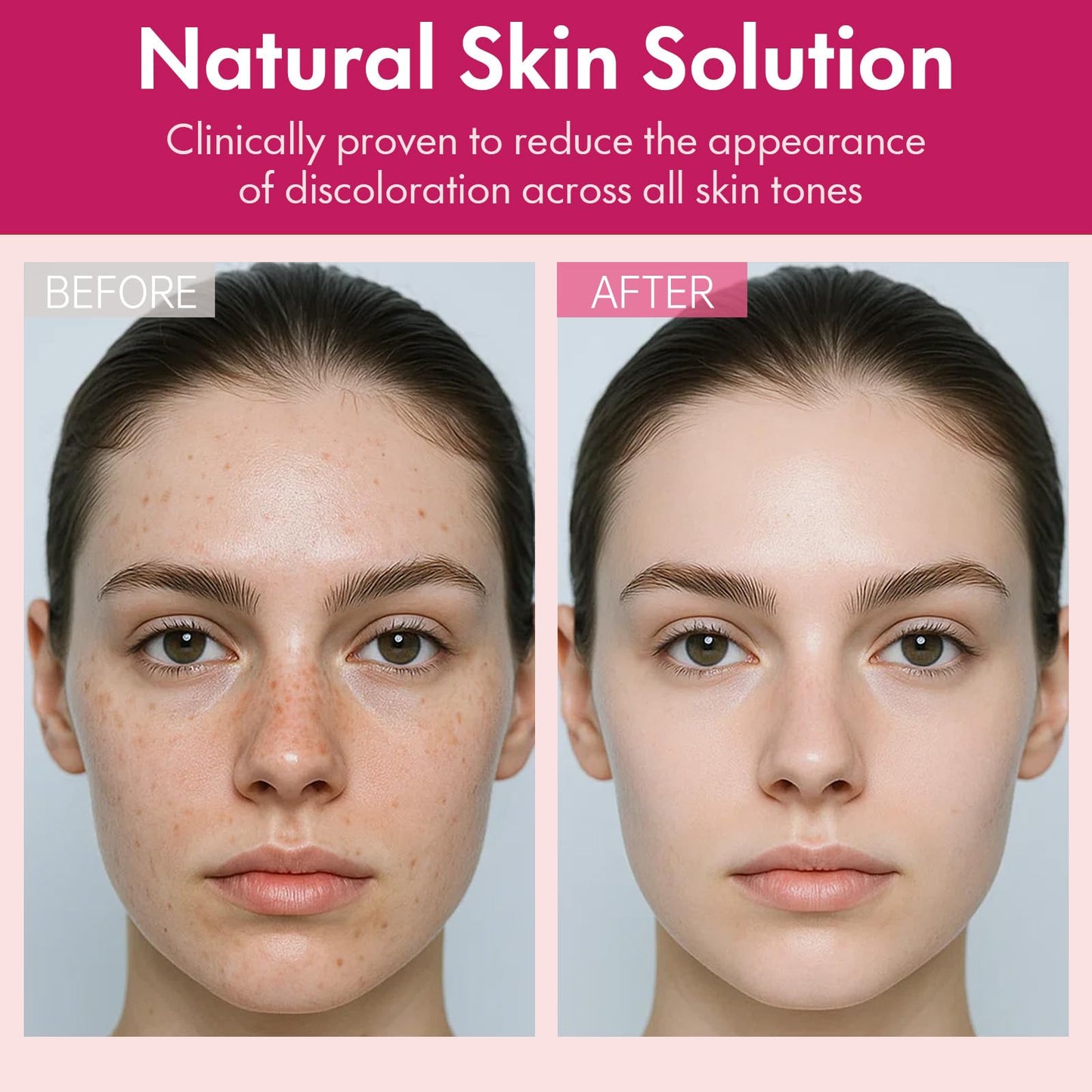Roseblem Arbutin 7% + Tranexamic Acid 4% Face Cream for Dark Spots & Uneven Skin Tone - Maple Wellness Supplements