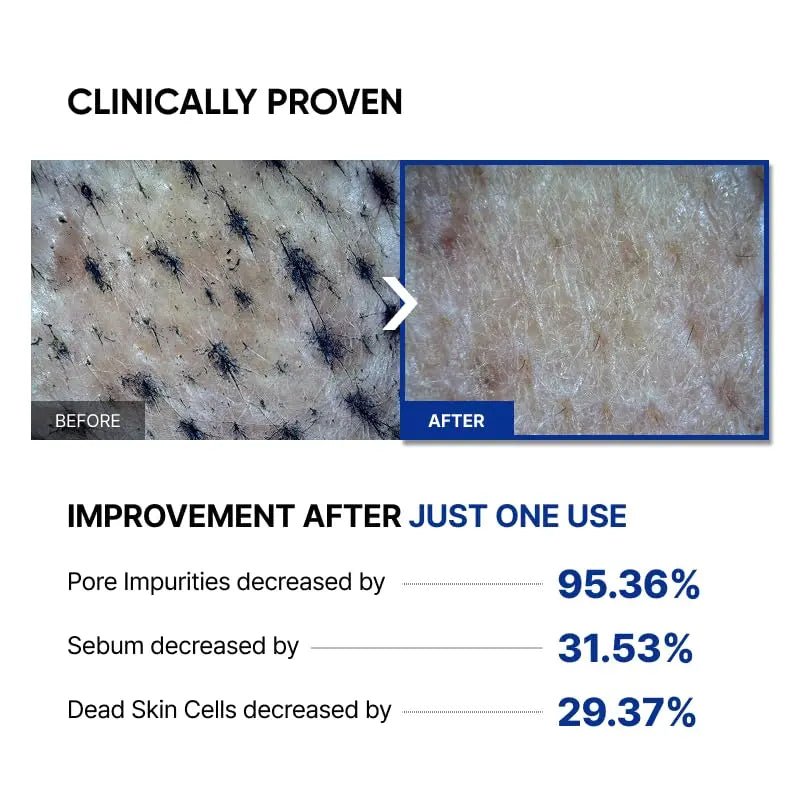 SAYNID MICROBIOME RENEWING CREAM MASK TRIAL KIT, Wash-off Cream, Soft Exfoliating Face Scrub Dead Skin Cells | 4.5g/0.15oz (3EA) - Maple Wellness Supplements