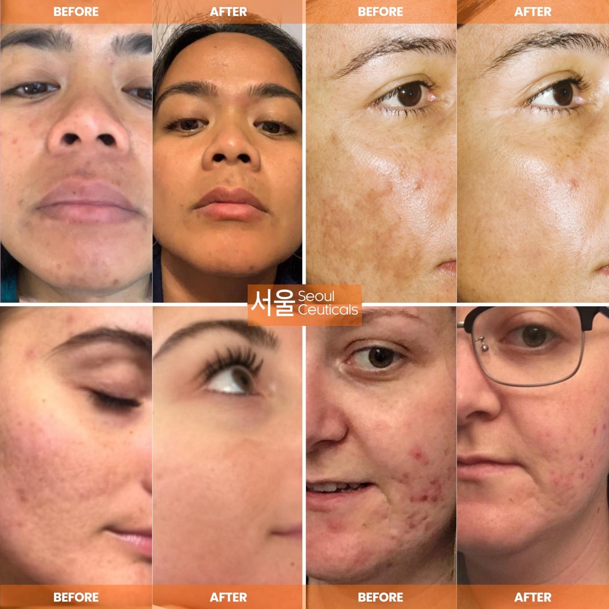 SeoulCeuticals Korean Skin Care 20% Vitamin C Hyaluronic Acid Serum + CE Ferulic Acid - Maple Wellness Supplements