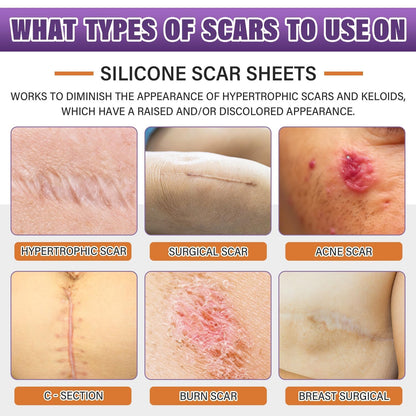 Silicone Scar Sheets,Silicone Scar Tape,Silicone Scar Removal Strips for Surgical,C-Section,Tummy Tuck,Keloid Scars - Maple Wellness Supplements