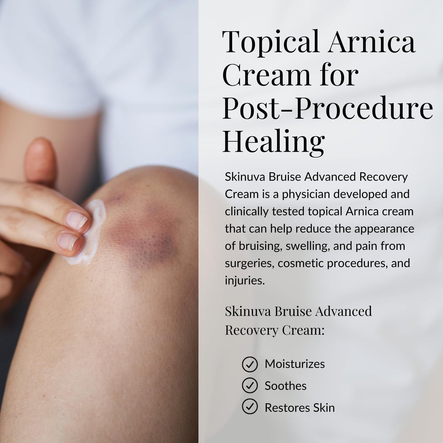 Skinuva® Bruise Advanced Recovery Cream - Topical Bruise Cream Formulated with Growth Factors, Arnica & Vitamin K (1 oz) - Maple Wellness Supplements