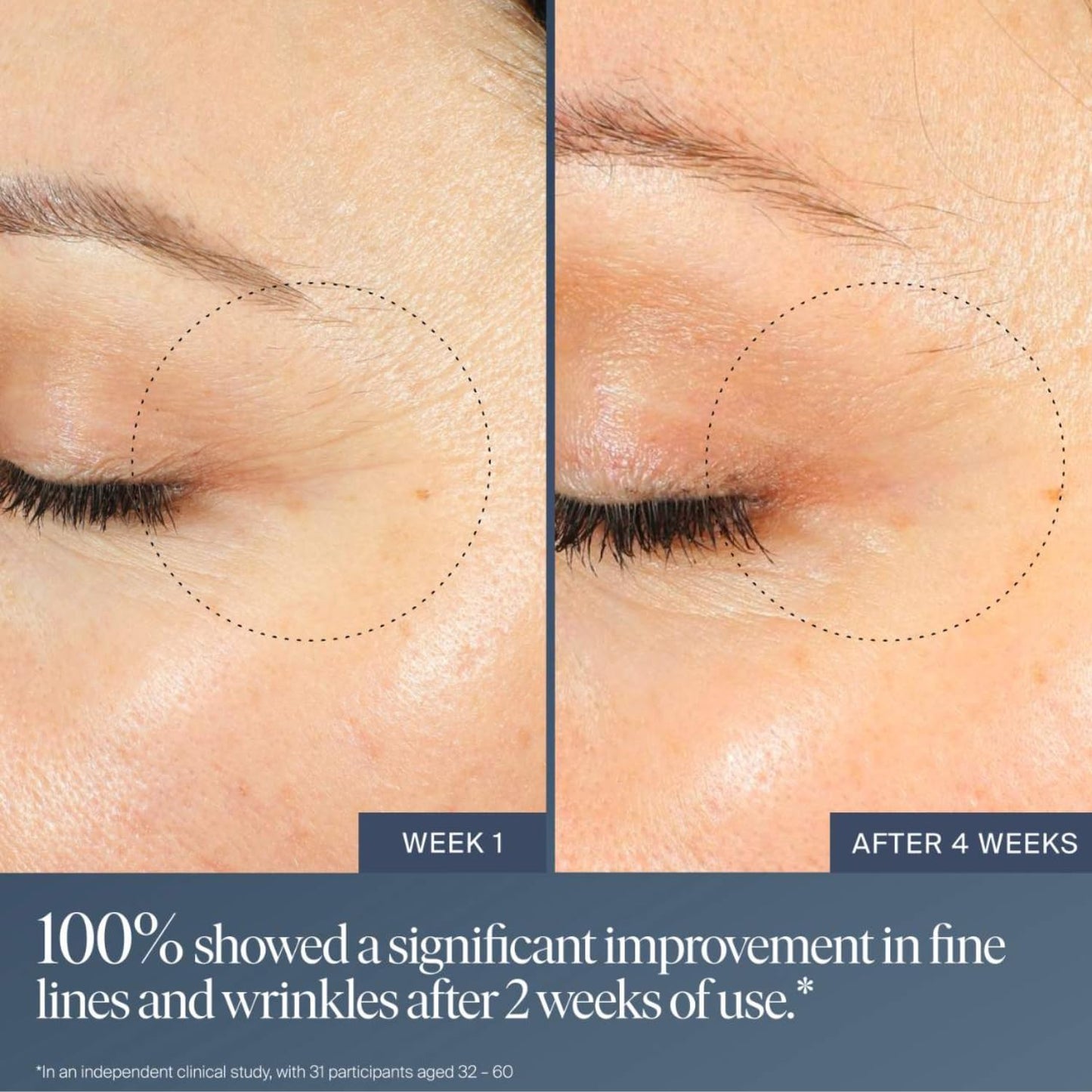 Summer Fridays Jet Lag Overnight Eye Serum - Nourishing Undereye Treatment for Dark Circles - Helps to Hydrate, Smooth, Firm & Depuff - Enriched with Glycerin to Lock in Moisture (0.5 Fl Oz) - Maple Wellness Supplements