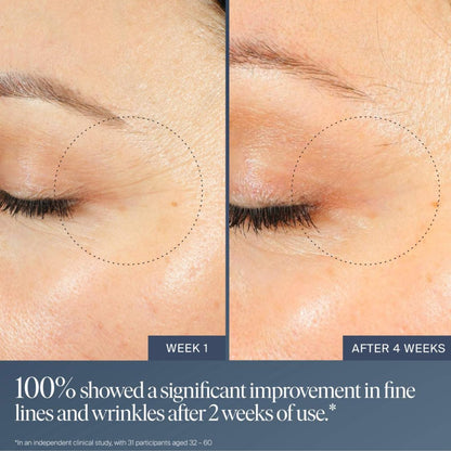 Summer Fridays Jet Lag Overnight Eye Serum - Nourishing Undereye Treatment for Dark Circles - Helps to Hydrate, Smooth, Firm & Depuff - Enriched with Glycerin to Lock in Moisture (0.5 Fl Oz) - Maple Wellness Supplements