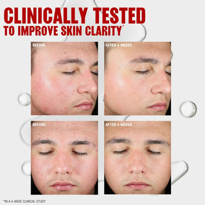 Thayers Blemish Clearing Salicylic Acid Toner, Acne Treatment Face Toner with 2% Salicylic Acid - Maple Wellness Supplements