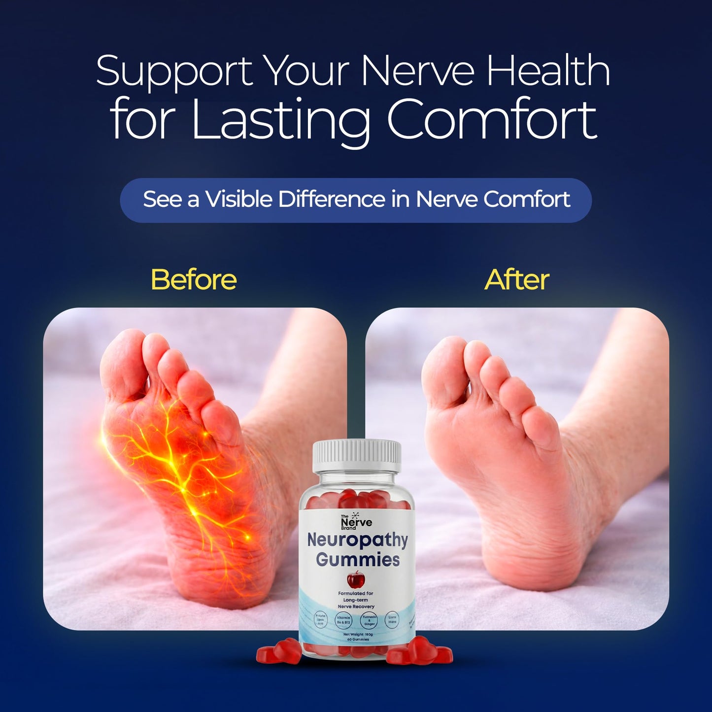 The Nerve Brand Neuropathy Support Gummies, 600 mg R Alpha Lipoic Acid Gummies with B1 B6 B12 and Lion’s Mane, Sugar Free Daily Nerve Health Supplement, 30 Day Supply - Maple Wellness Supplements