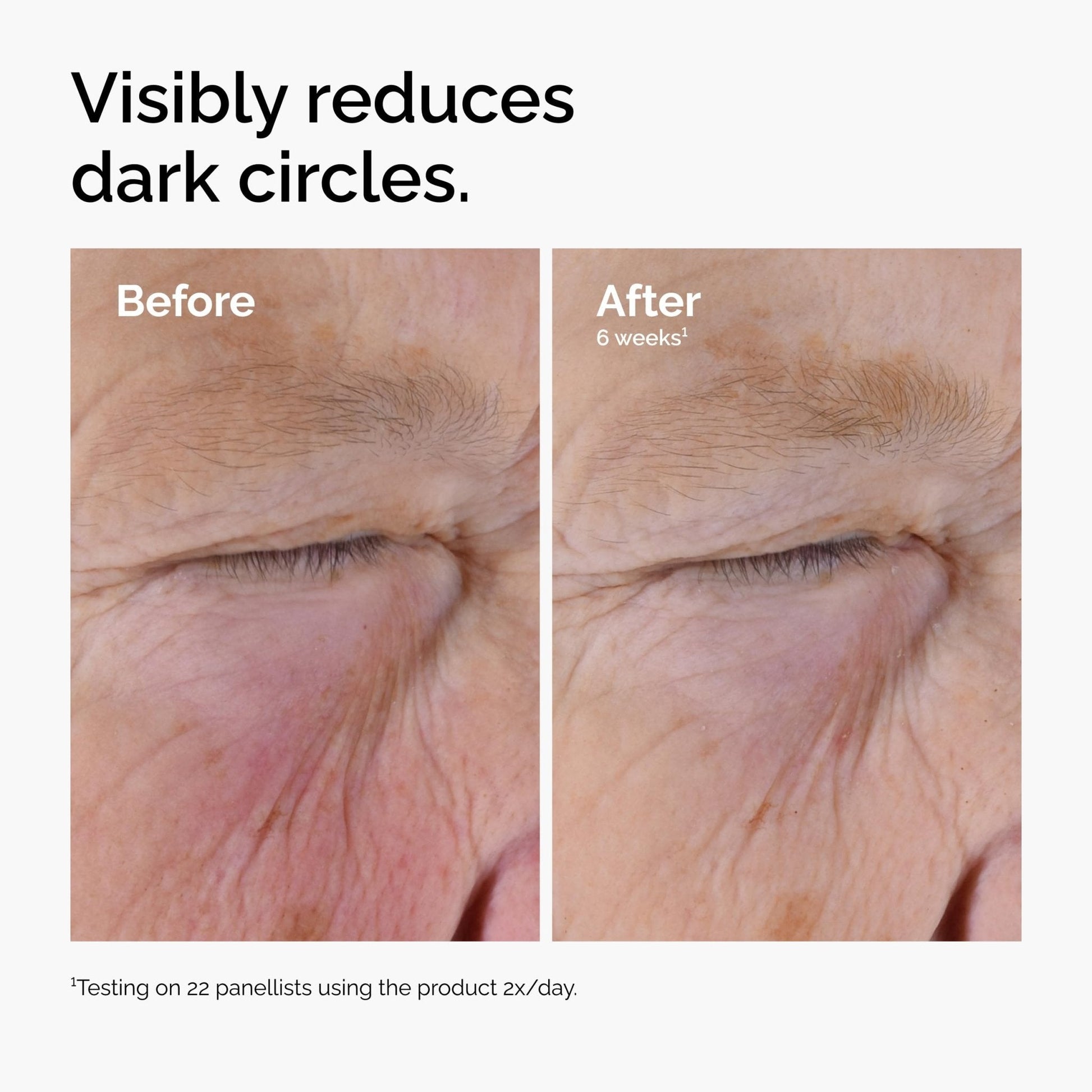 The Ordinary Caffeine Solution 5% + EGCG, Depuffing Eye Serum for Dark Circles and Tired Eyes, 1 Fl Oz - Maple Wellness Supplements