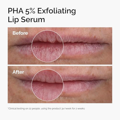 The Ordinary PHA 5% Exfoliating Lip Serum, Hydrating Overnight Lip Exfoliator Treatment, 0.5 Fl Oz - Maple Wellness Supplements