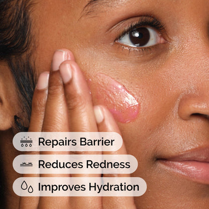 The Ordinary Soothing & Barrier Support Serum, Redness-Reducing & Hydrating Solution for Skin Barrier Recovery, 1 Fl Oz - Maple Wellness Supplements
