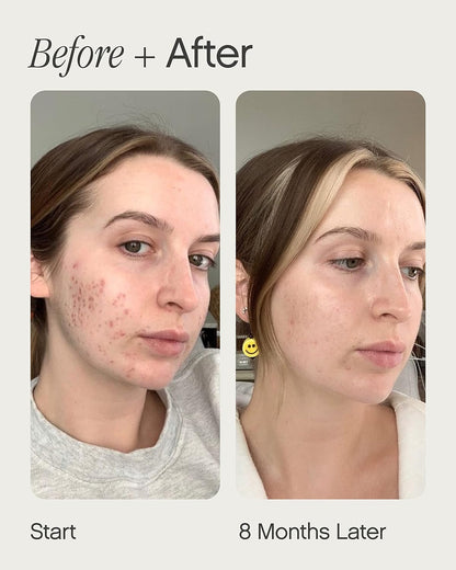 Topicals Faded Brightening and Clearing Serum | Reduces Discoloration, Post-Blemish Marks, Scars and Spots - Maple Wellness Supplements