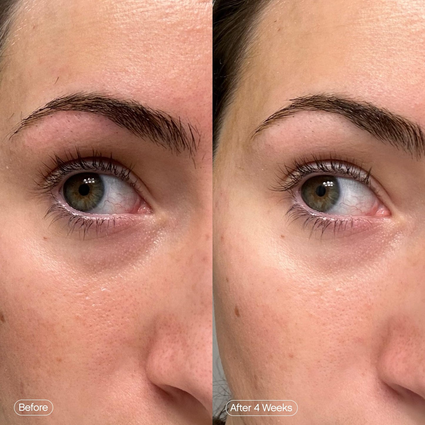 Topicals Faded Brightening Under Eye Masks | Patches to Depuff, Hydrate, Brighten and Cool | Reduce Dark Circles and Fine Lines | Contains Kojic Acid, Caffeine and Niacinamide (Set of 6) - Maple Wellness Supplements