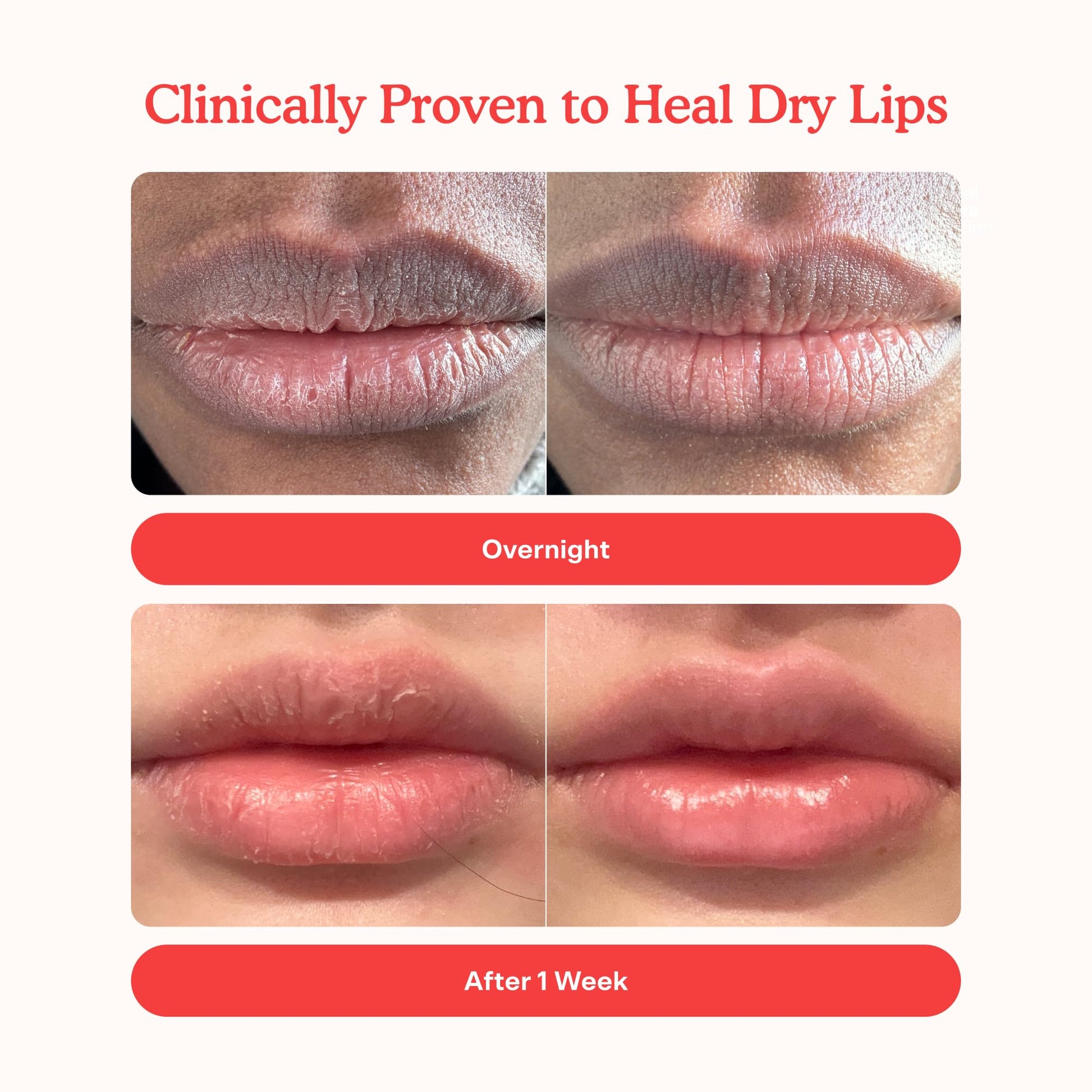 Tower 28 LipSoftie Tinted Lip Balm Treatment - Hydrating Glossy Balm + Overnight Lip Mask - Maple Wellness Supplements