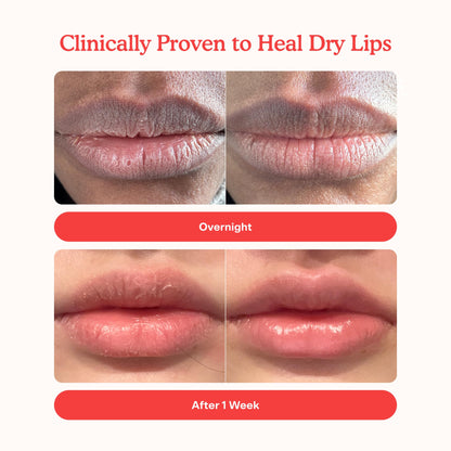 Tower 28 LipSoftie Tinted Lip Balm Treatment - Hydrating Glossy Balm + Overnight Lip Mask - Maple Wellness Supplements