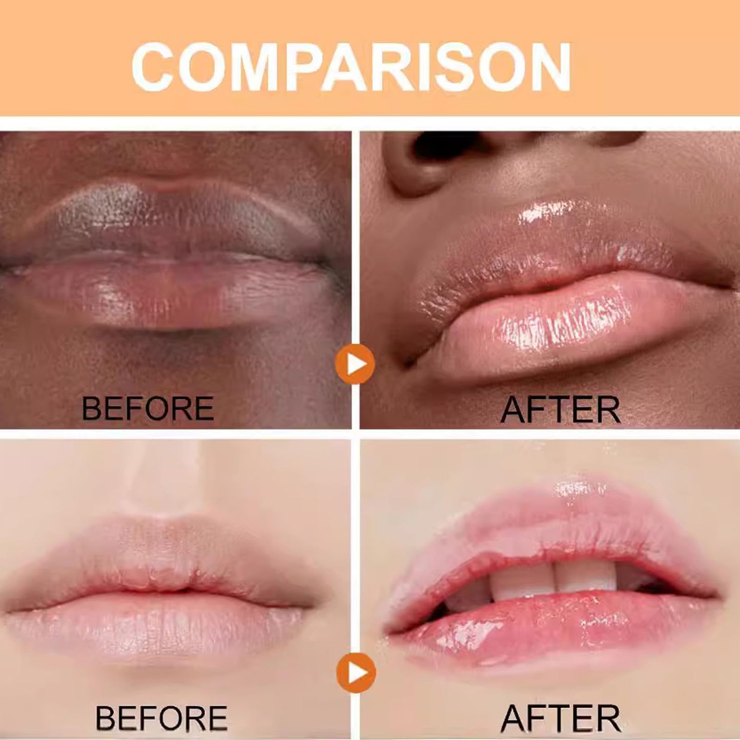 Turmeric Lip Balm for Smokers With Root Oil - Brightening for Dark Lips, Long-Lasting Moisturizer for Dry - Maple Wellness Supplements