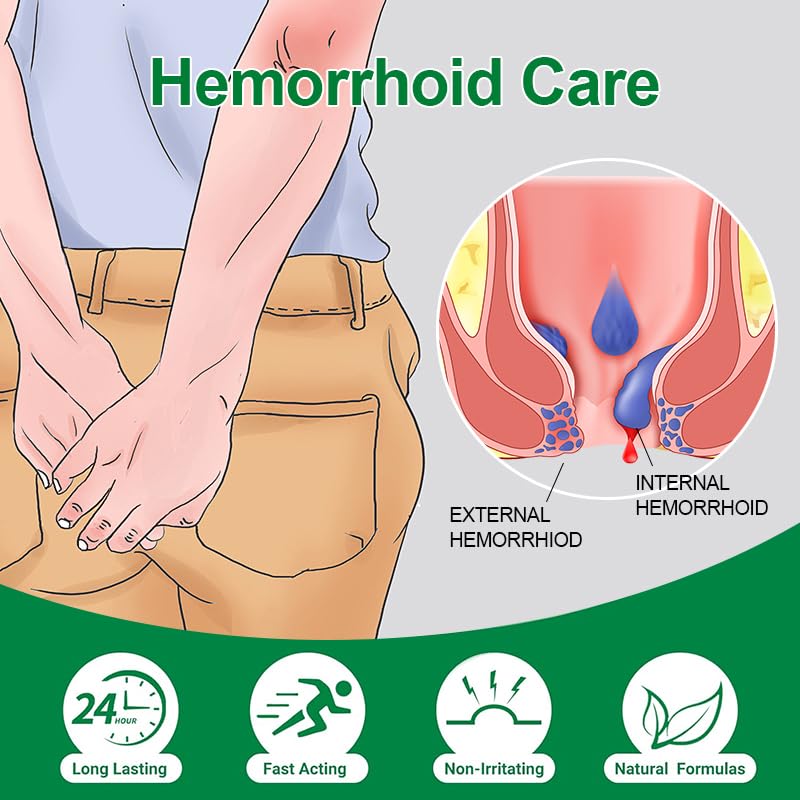vamy Hemorrhoid Ointment (2 x 20g Tubes), 40g - Maximum Strength Formula for Hemorrhoidal Fast Relief, Soothes Itching, Burning & Discomfort - Maple Wellness Supplements