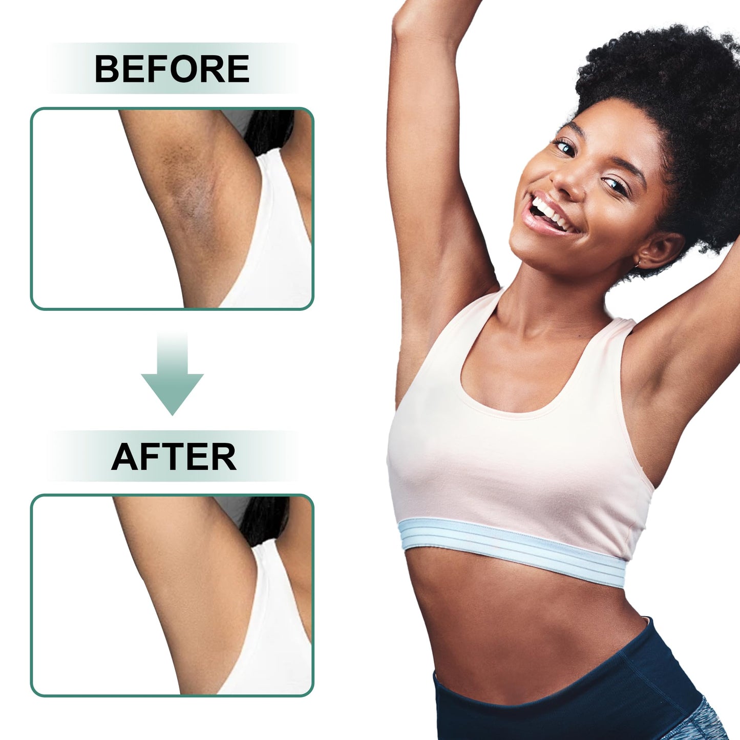 Vcetree Skin Bleaching Cream Skin Lightening for Body Intimate Areas, Private Parts, Underarm, Knees, Elbows, Inner Thigh, Bikini Area - Maple Wellness Supplements