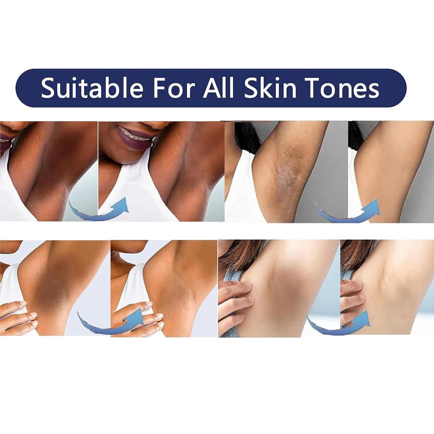 Vcetree Skin Bleaching Cream Skin Lightening for Body Intimate Areas, Private Parts, Underarm, Knees, Elbows, Inner Thigh, Bikini Area - Maple Wellness Supplements