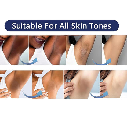 Vcetree Skin Bleaching Cream Skin Lightening for Body Intimate Areas, Private Parts, Underarm, Knees, Elbows, Inner Thigh, Bikini Area - Maple Wellness Supplements