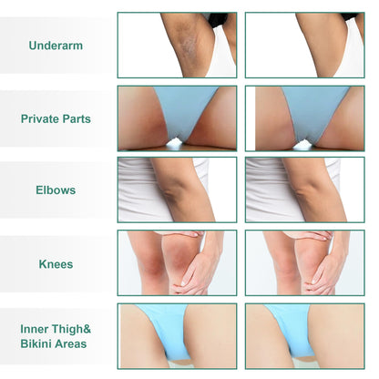 Vcetree Skin Bleaching Cream Skin Lightening for Body Intimate Areas, Private Parts, Underarm, Knees, Elbows, Inner Thigh, Bikini Area - Maple Wellness Supplements