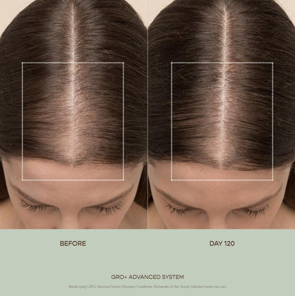 VEGAMOUR GRO+ Advanced Essentials Kit | Removes Buildup, Improves Hair Density, Reduces Shedding, Hydrates and Exfoliates the Scalp | For Severe Signs of Thinning | Color Safe, Vegan, Cruelty-Free - Maple Wellness Supplements