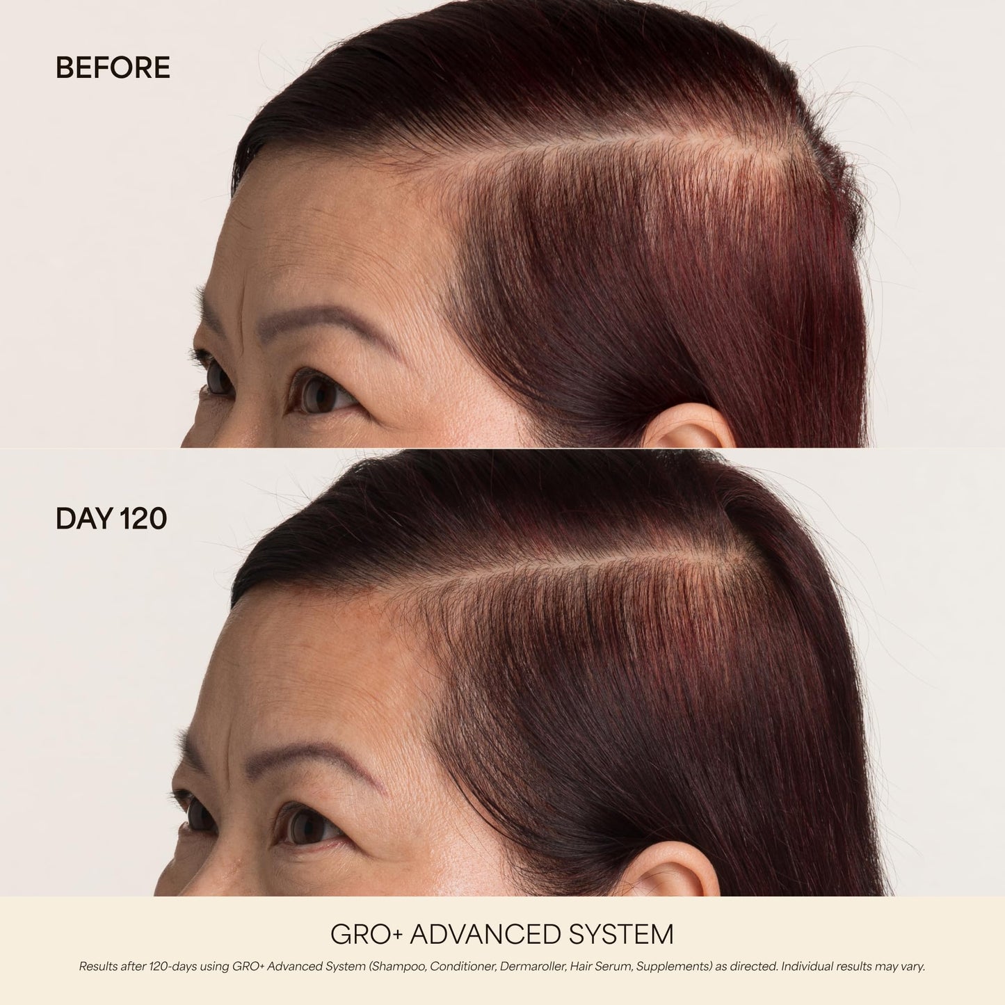 VEGAMOUR GRO+ Advanced Hair Growth Vitamin Supplements - Boosts Hair Growth & Density - 30 Pill Packs/Box - Maple Wellness Supplements