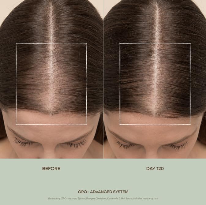 VEGAMOUR GRO+ Advanced Hair Serum for Improving Hair Density, Tonic Reduces Shedding and Promotes a Healthy Scalp, 1 pack - Maple Wellness Supplements