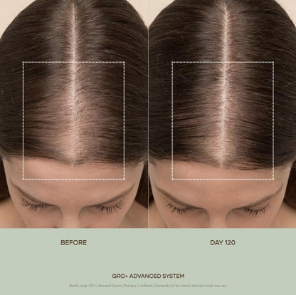 VEGAMOUR GRO+ Advanced Hair Serum for Improving Hair Density, Tonic Reduces Shedding and Promotes a Healthy Scalp, 1 pack - Maple Wellness Supplements