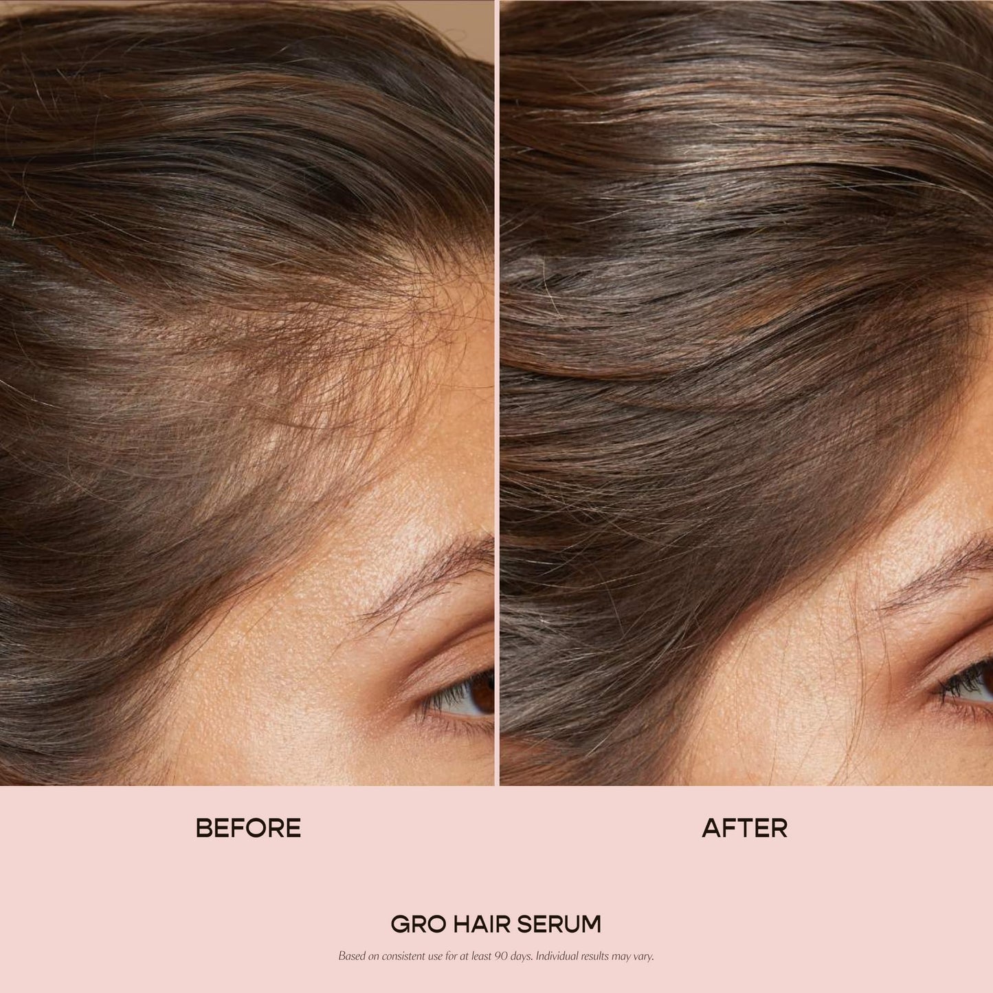 VEGAMOUR GRO Hair Serum for Hair Thinning, Thicker Fuller Looking Hair, Non Oily Tonic, 3 pack, 90 day supply - Maple Wellness Supplements