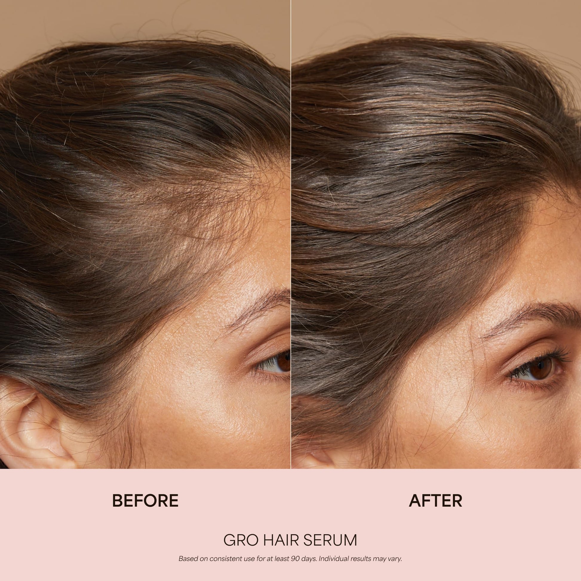 VEGAMOUR GRO Healthy Hair Starter Kit | Full Size GRO Serum for Thinning & Shedding plus Travel Size Shampoo and Conditioner with Vegan Keratin to Support Thicker, Fuller Looking Locks | $92 Value - Maple Wellness Supplements