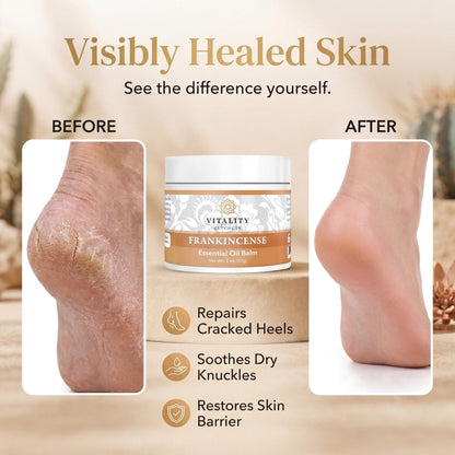 Vitality Extracts Frankincense Balm - 2oz, Boswellia Serrata, Beeswax, Olive Oil, Moisturizer for Dry, Cracked Skin, All Skin Types - Maple Wellness Supplements