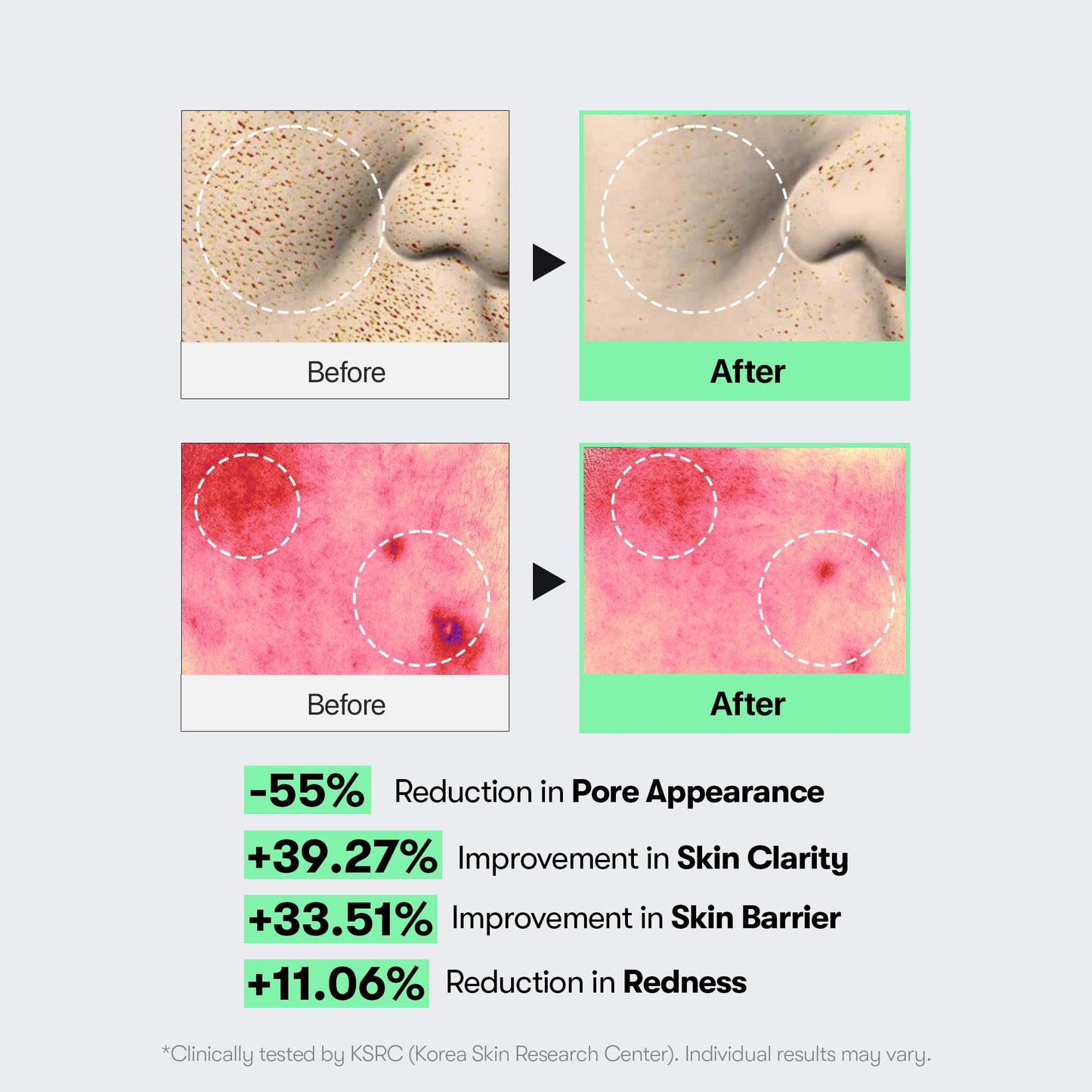 VT COSMETICS CICA Reedle Shot 100, Spicule Microneedling Serum for Pore Care & Exfoliation, Exosome, Centella Asiatica for Glass Skin - Maple Wellness Supplements