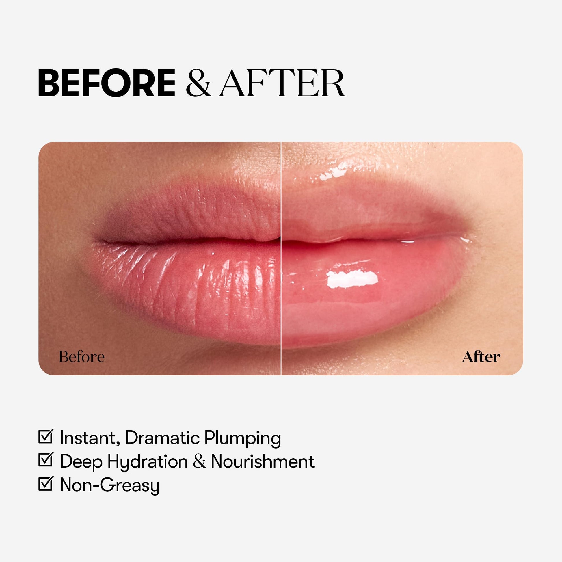 VTCOSMETICS Reedle Shot Lip Plumper, 0.15 oz (4.3 g), Moisturizing, Transparent, Lip Gloss, Fragrance-free, Korean Cosmetics (Expert) - Maple Wellness Supplements