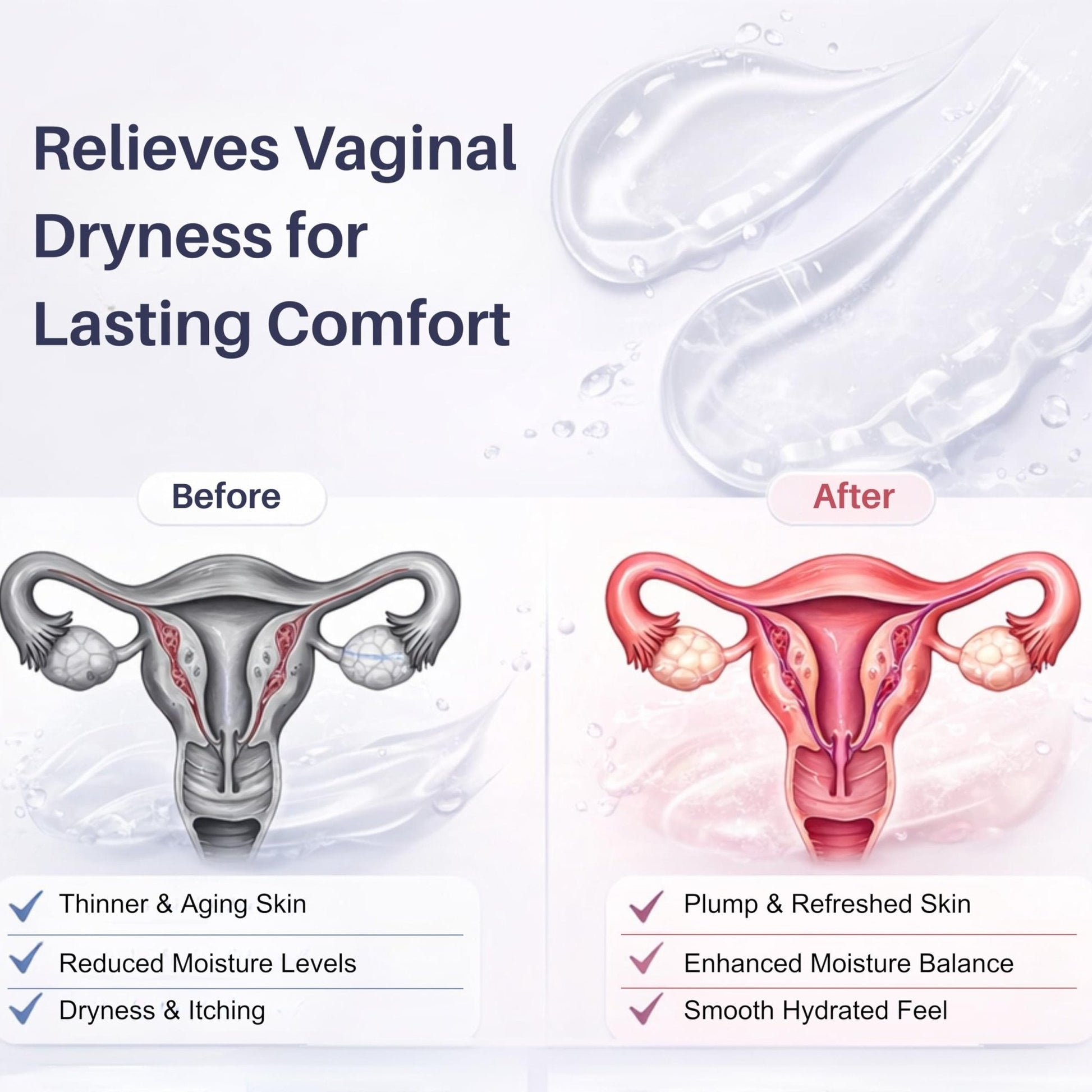 XORYTEN Vaginal Moisturizer for Revarey– 5mg Hyaluronic Acid – Vaginal Dryness, Hormone-Free Soothing Inserts, Non-Greasy, 12 Suppositories – 1 Month Supply (No fragrance) - Maple Wellness Supplements