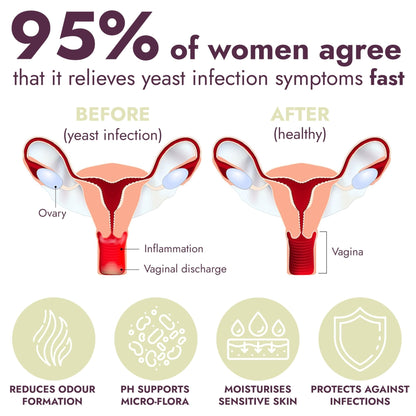 Yeast Infection Treatment for Women | Boric Acid Suppositories For Women | Helps Relieve Itching & Irritation | Vaginal Aid for Inflammation, Dryness & Watery Discharge | 12 Vaginal Suppositories - Maple Wellness Supplements