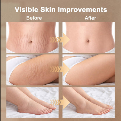 ZRCZRC Lymphatic Drainage Massager, Lymphatic Massager, Helps Reduce Stretch Marks & Cellulite, for Legs, Arms & Belly, Body Sculpting Machine with Microcurrent, Light, Heat & Vibration, White - Maple Wellness Supplements